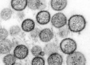 Anggota DPRD Maluku Minta Pemda Waspada Hantavirus, Jangan Tunggu Ada Kasus