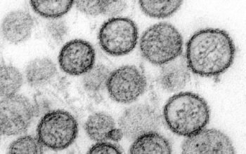 Anggota DPRD Maluku Minta Pemda Waspada Hantavirus, Jangan Tunggu Ada Kasus