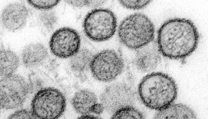 Anggota DPRD Maluku Minta Pemda Waspada Hantavirus, Jangan Tunggu Ada Kasus